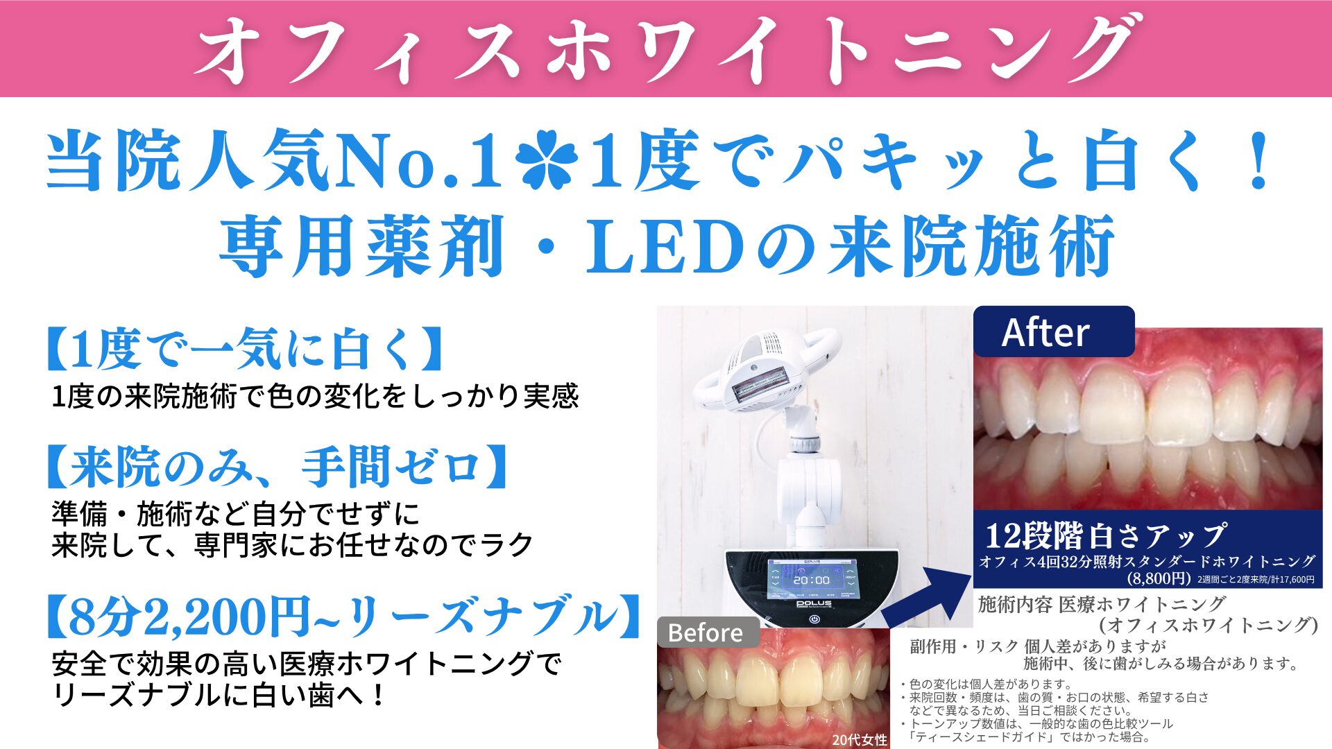 歯医者 ホワイトニング 値段