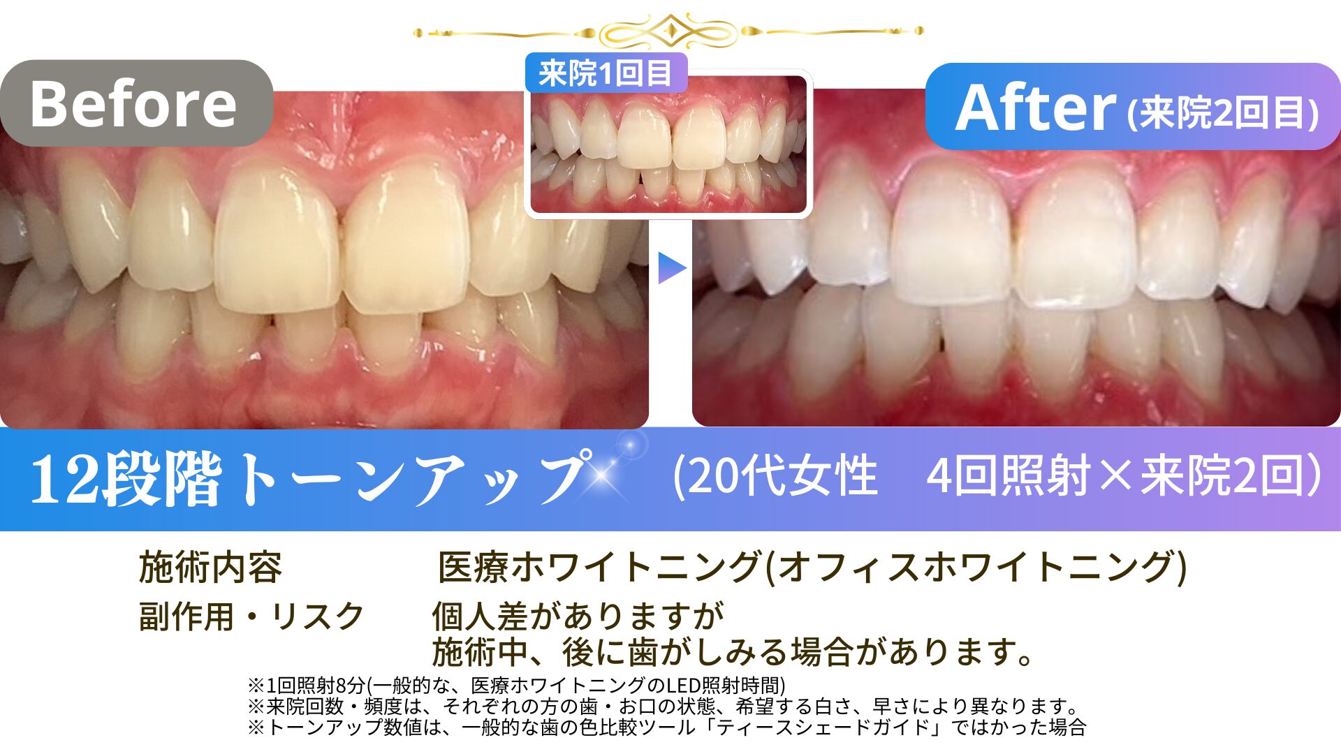 女性　口元　高画質 