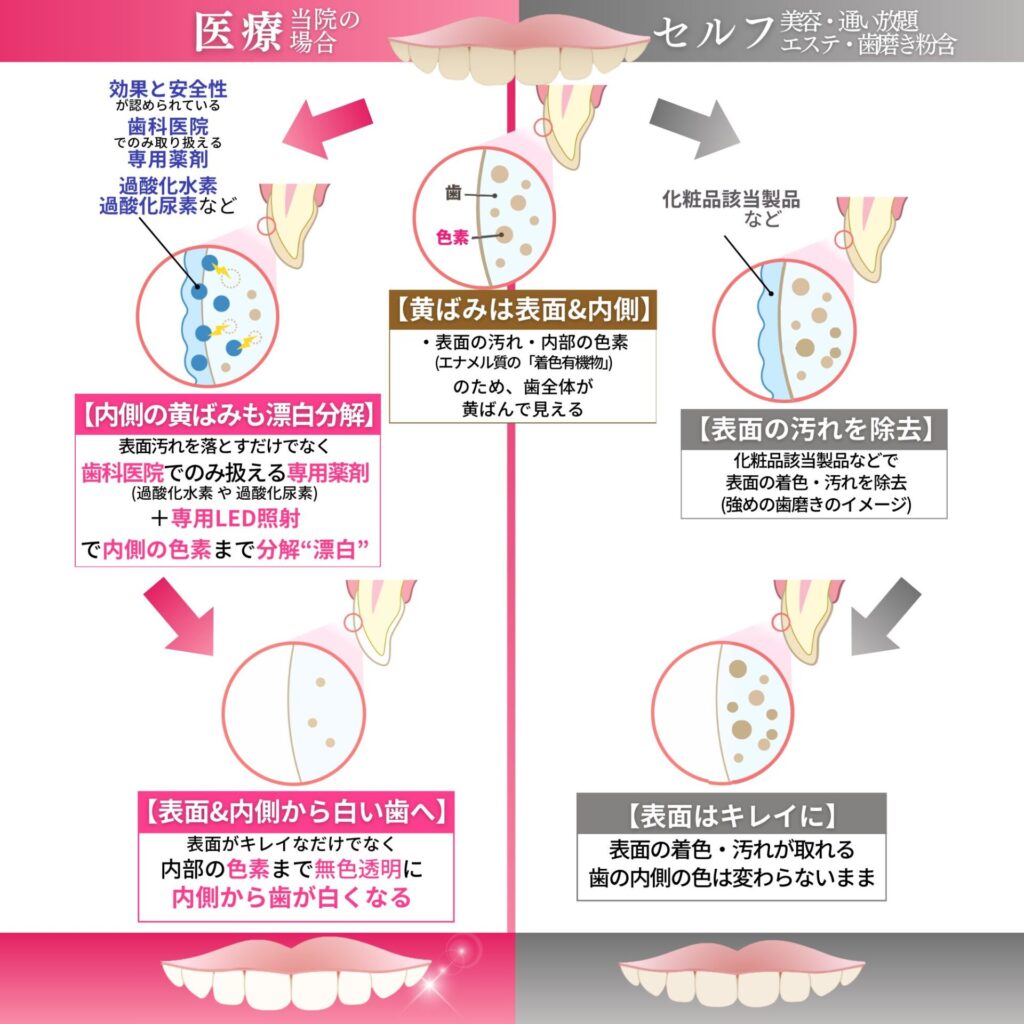 医療ホワイトニングとは？都内最安2,200円～【さくらプラチナム歯科 