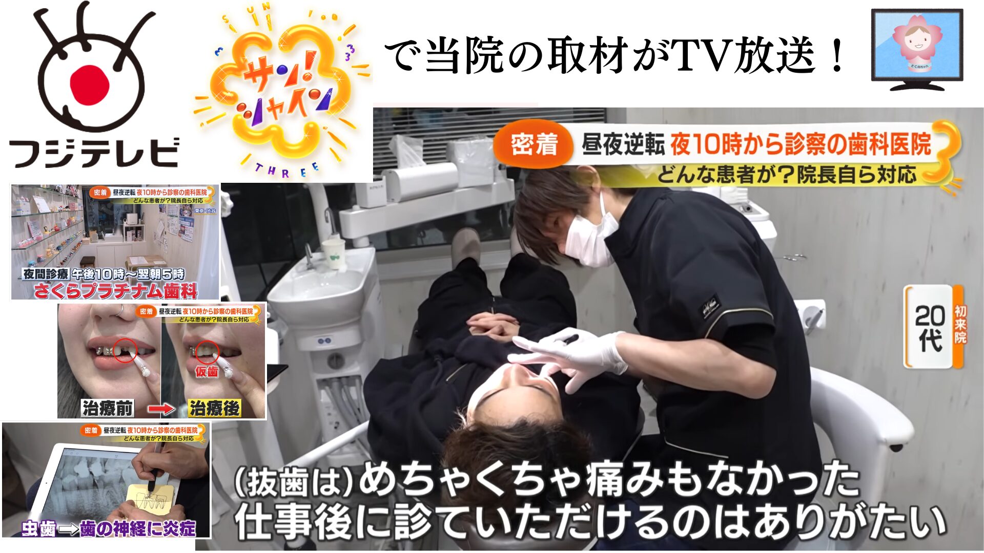 テレビ放送】深夜診療を行う歯科医院としてフジテレビ『サン!シャイン 