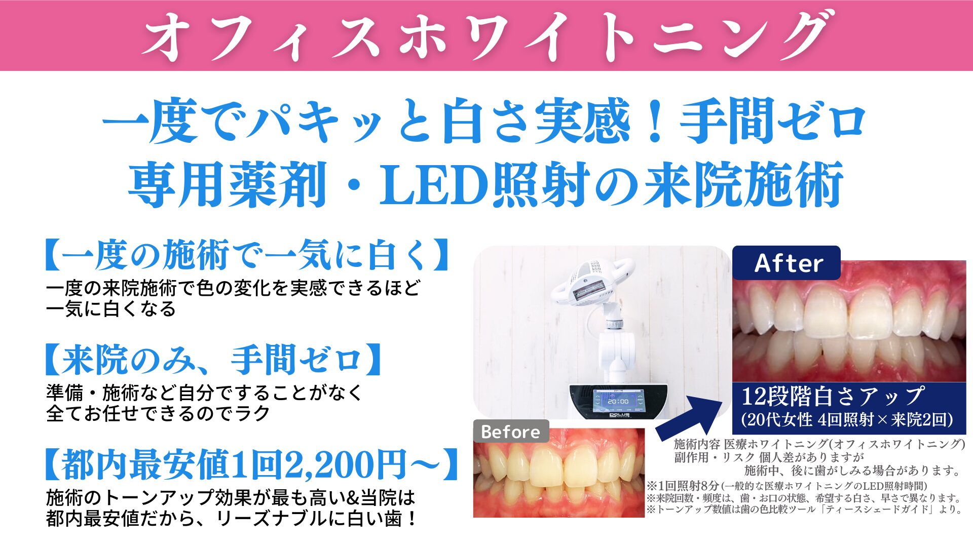 オフィスホワイトニングの効果はどれくらい持続する？白さを長持ちさせる秘訣